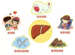 治疗丙肝的方法(治疗丙肝的方法是)