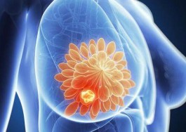 乳腺炎的治疗方法(月子里急性乳腺炎的治疗方法)