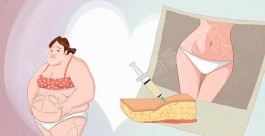 吸脂减肥方法(吸脂减肥方法多少钱)