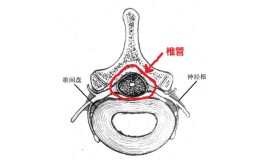 椎管狭窄的锻炼方法(椎管狭窄的锻炼方法视频)
