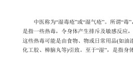 小儿湿疹最佳治疗方法(小儿湿疹最佳治疗方法 中医)