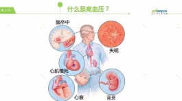 快速降血压的方法(体检前快速降血压的方法)