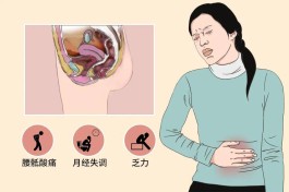 盆腔炎的治疗方法(女性盆腔炎的治疗方法)