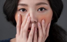 去红血丝最好的方法(去脸上红血丝最有效的方法)