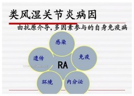 风湿性关节炎治疗方法(风湿性关节炎治疗方法哪种好)