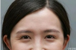 鱼尾纹除皱方法(眼角纹怎么消除简单方法)