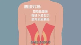 腰肌劳损治疗最佳方法(腰肌劳损治疗最佳方法小燕飞)