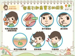 鼻窦炎治疗最好的方法(9岁鼻窦炎治疗最好的方法)