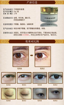汗管瘤的根治方法(汗管瘤的根治方法多钱)