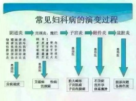 妇科炎症的治疗方法(妇科炎症能治疗好吗)