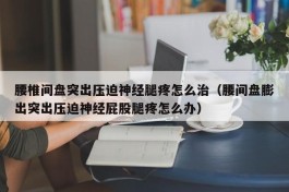 腰椎间盘突出压迫神经腿疼怎么治（腰间盘膨出突出压迫神经屁股腿疼怎么办）