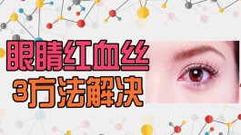 去红血丝的方法(去红血丝的方法有什么)