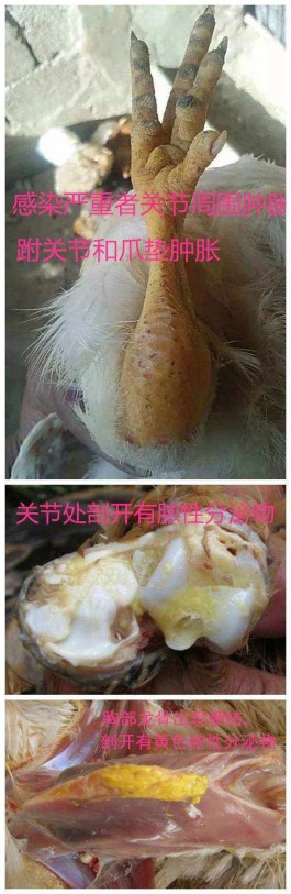 滑囊炎最佳治疗方法(脚踝滑囊炎最佳治疗方法)