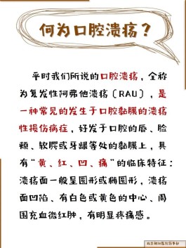 口腔溃疡最快痊愈方法(口腔溃疡最快痊愈方法产生的原因)