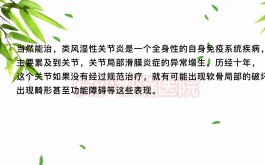 类风湿的治疗方法(国外类风湿的治疗方法)