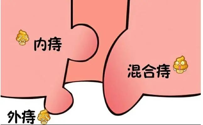 内痔疮最佳的自愈方法图片