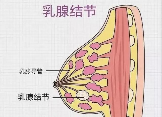 乳腺结节的治疗方法(乳腺结节的治疗方法和比例)