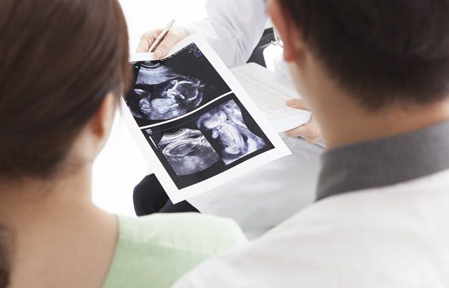 胎儿性别鉴定方法(胎儿鉴别男女几个月)